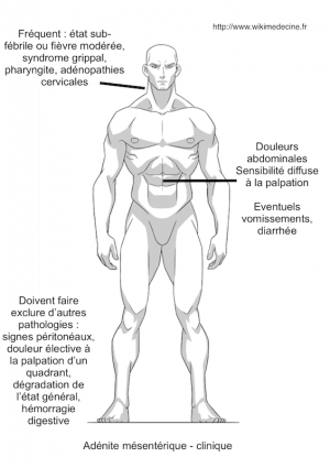 Adénite mésentérique - sémiologie clinique