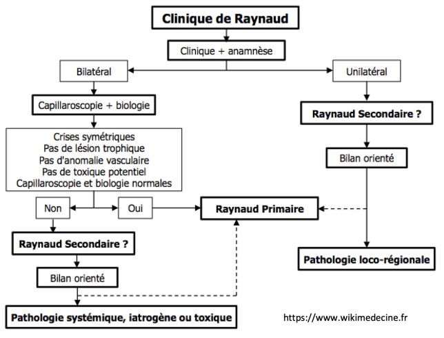 Syndrome de Raynaud - Démarche diagnostique